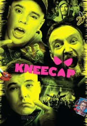Kneecap
