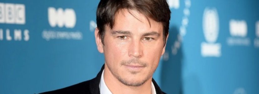 Ünlü Oyuncu Josh Hartnett Araba Kazası Geçirdi!